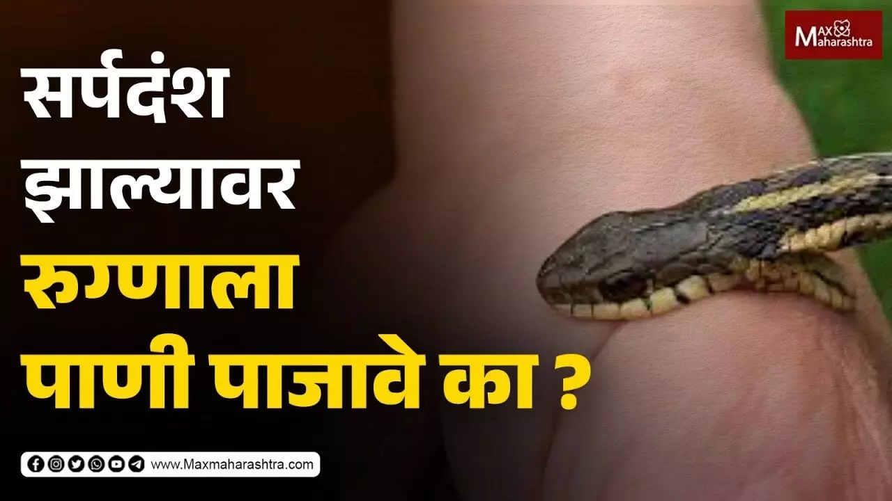 सर्पदंश झाल्यावर रुग्णाला पाणी पाजावे का ?